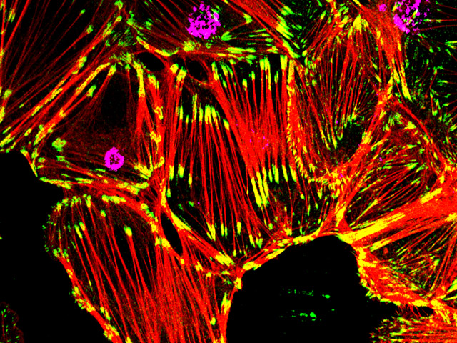 Infectious Disease - Fluorescent microscope Image of Cells