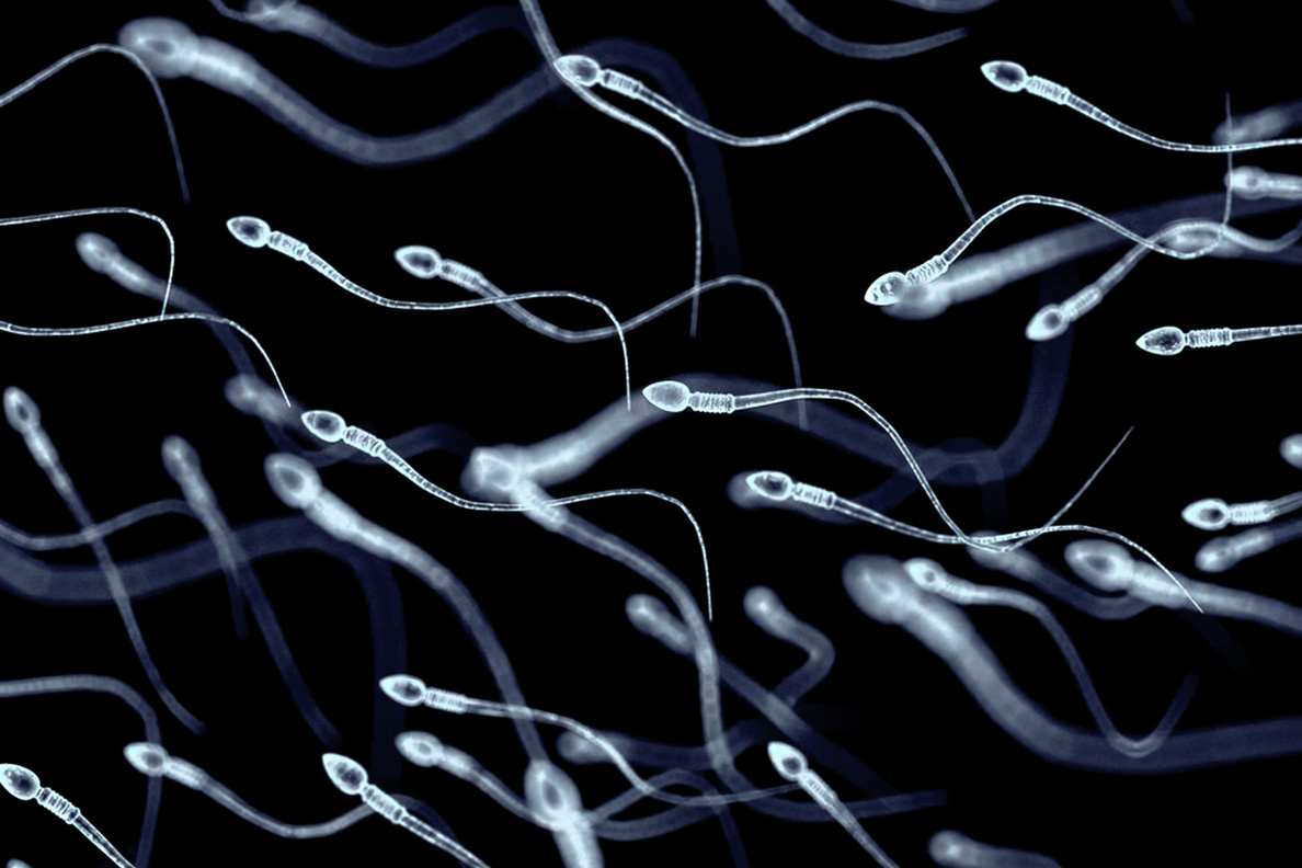 Illustration of spermatozoa, viewed under a microscope.